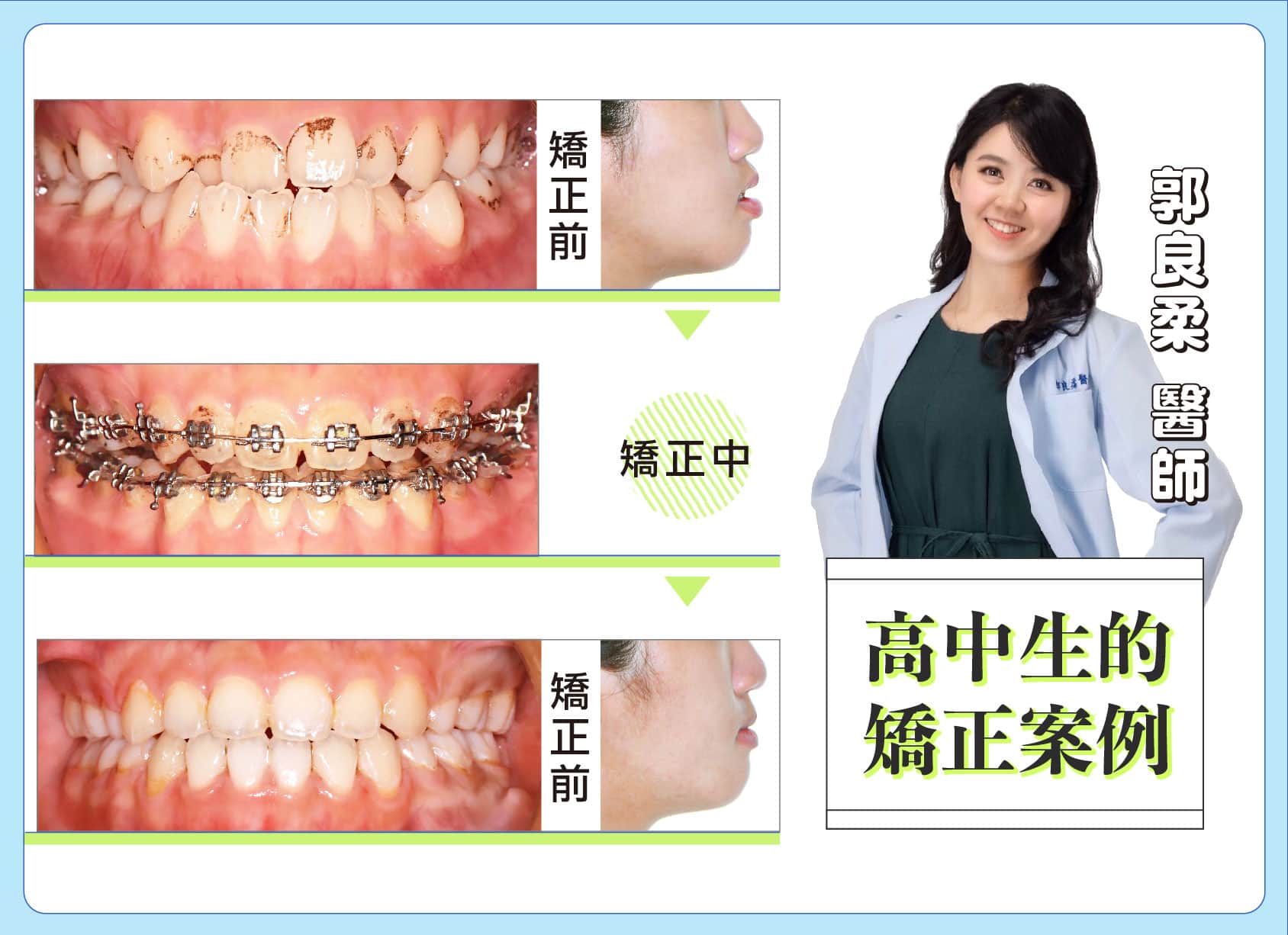 15歲高中生的傳統矯正